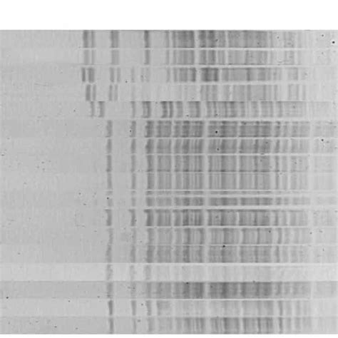 Pulsed Field Gel Electrophoresis Profiles Of XbaI Digested Genomic DNA