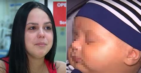 Salvan Vida A Beb De Madre Cubana Con Cirug A Intrauterina Realizada