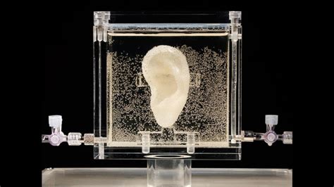 3d Bioprinting Regenerates Vincent Van Gogh S Severed Ear From Relative S Dna Ibtimes Uk