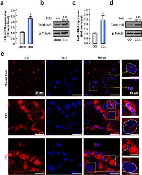 HuR Is Up Regulated And Translocates To Cytoplasm During Liver