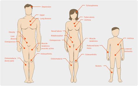 Symptoms Of Vitamin D Deficiency Vitamin D Guru