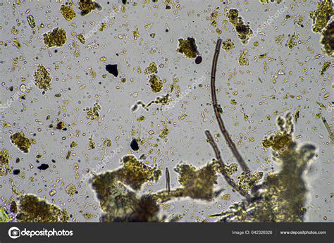 Soil Microorganisms Soil Sample Soil Fungus Bacteria Regenerative Farm ...