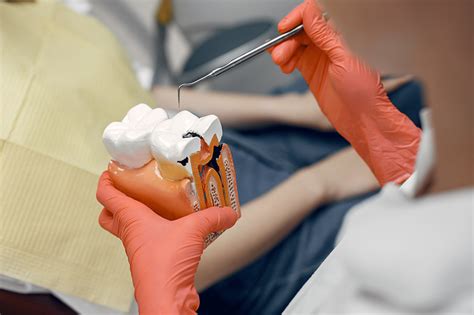 Understanding Root Canal Treatment Cost And Quality