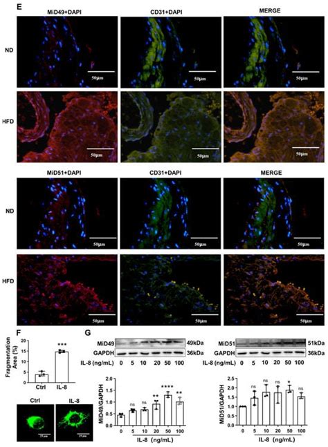 IJMS Free Full Text Dynamin Related Protein 1 Binding Partners