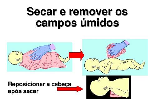 Cuidados Mediatos E Imediatos Ao Rn