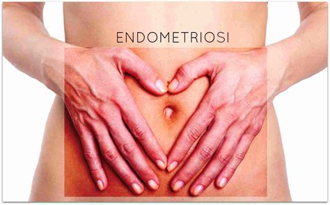 Endometriosi Diagnosi E Cura Dell Endometriosi Seno Clinic Si Parla