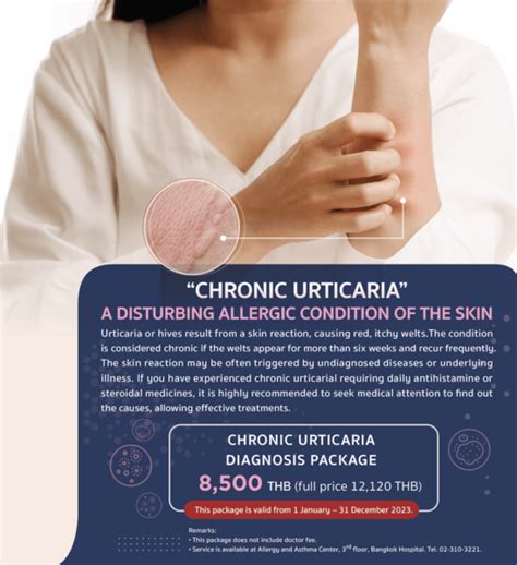 Chronic Urticaria diagnosis package | Bangkok Hospital