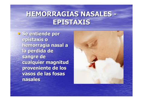 HEMORRAGIAS NASALES