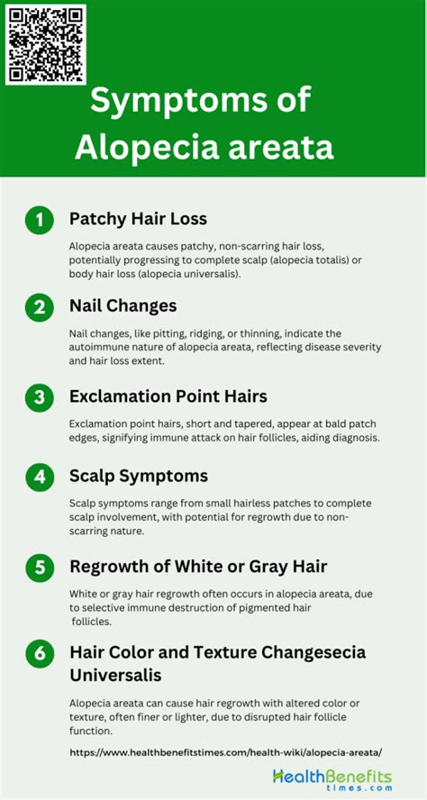 Symptoms of Alopecia areata | Health Benefits