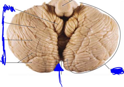 Neuro Lab1 Cerebellum Flashcards Quizlet