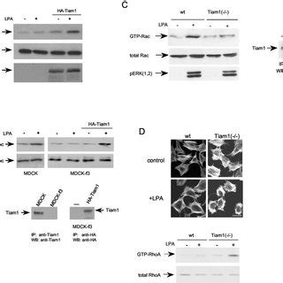 LPA 1 Receptor Signaling Pathways Leading To Activation Of Rac And