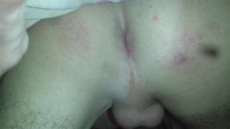 Asshole Gay Man Porn XHamster