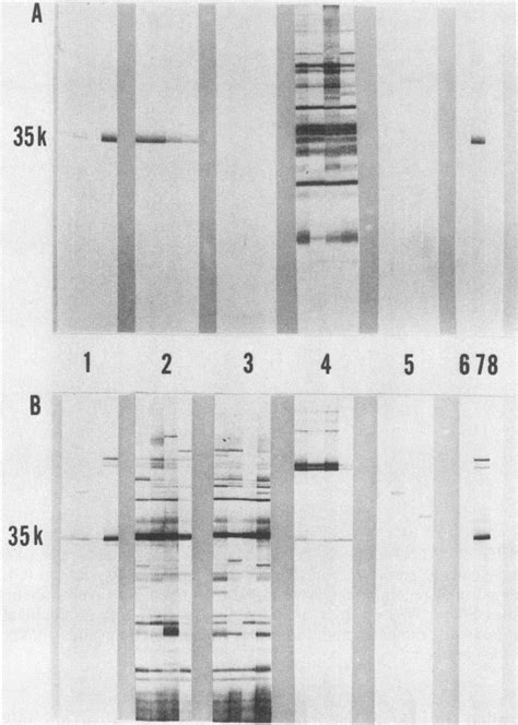 Western Blot Immunoblot Strips Of M Tuberculosis Sonic Extract A