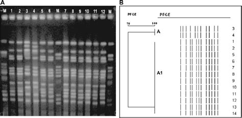 A An Example Of The Pfge Profiles Of The Outbreak Strains Of P