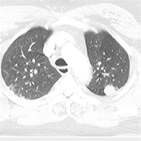 ct angiography chest  scientific diagram
