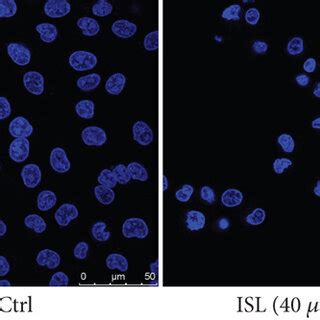 Isoliquiritigenin Induces Apoptosis In A375 Melanoma Cells A Cell