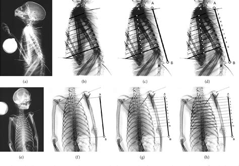 Figure 1 From The Thoracic Shape Of Hominoids Semantic Scholar