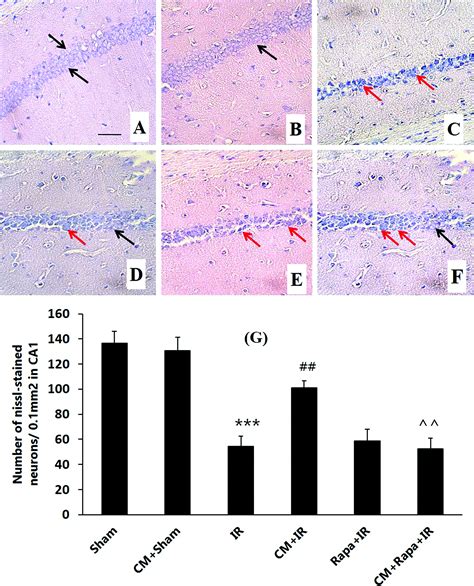 Preconditioning With Morphine Protects Hippocampal Ca1 Neurons From