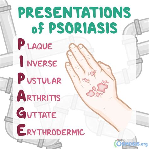 Osmosis From Elsevier On Twitter Todays Clinicalpearl Goes Deep