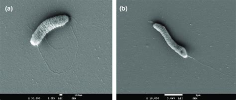 Scanning electron microscope images of Campylobacter magnus 46386 T at ...