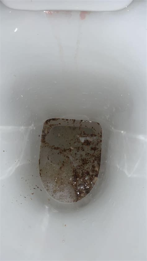 brown vomit ?? : r/medical