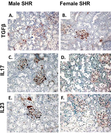 Figure 1 From Sex And Gender Differences In T Cells In Hypertension Semantic Scholar