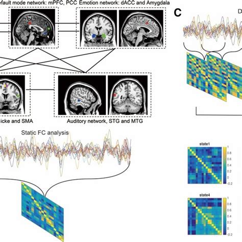 Connectivity Patterns Of Six Brain States In Dynamic Brain Notes