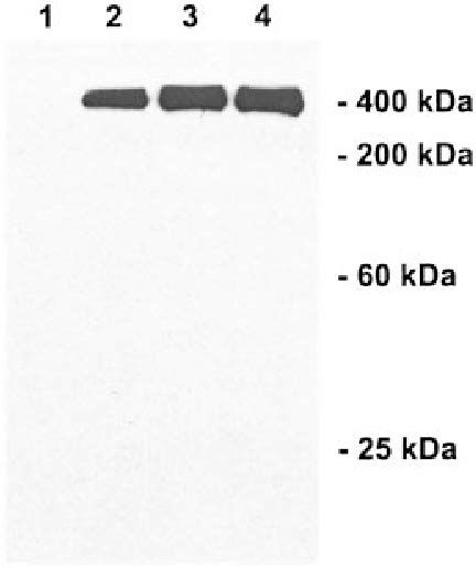 Figure From Mutational Analysis Of The Proteolytic Domain Of