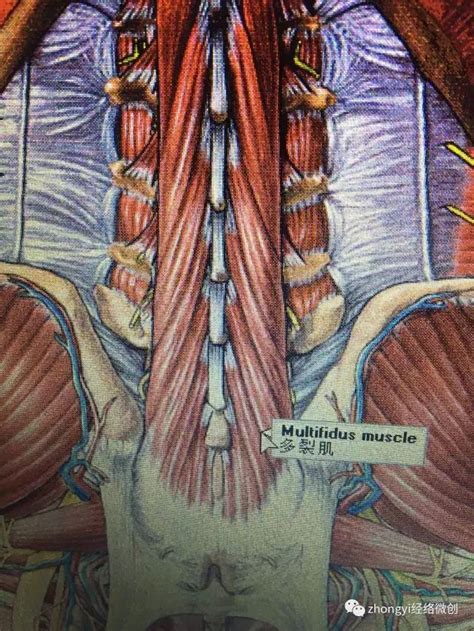 腰肌劳损骶棘肌位置图 骶棘肌位置示意图 腰肌劳损压痛点位置图 第4页 大山谷图库