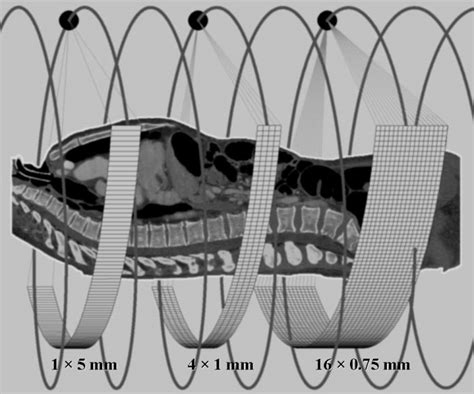 Evolution Of Detector Systems In Spiral Ct Whereas Single Slice