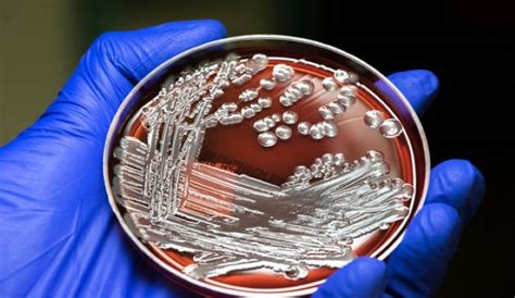 CDC Identifies Additional E. Coli Infection Cases