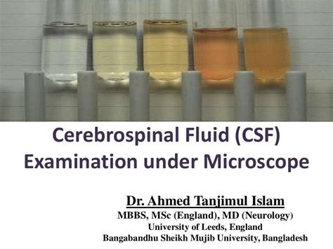 Cerebrospinal Fluid Csf Examination Under Microscope