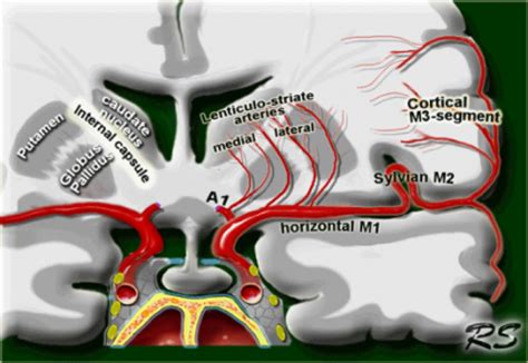 Middle Cerebral Artery Anatomy Radiology Notes