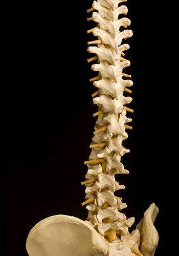 Kyphosis Surgery & Scoliosis Surgery | Dr Baker Neurosurgery