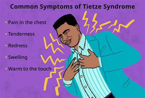 Tietze Syndrome: Signs, Symptoms, and Complications