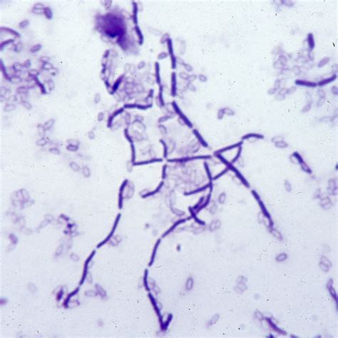 Morphology Of Bacillus Subtilis