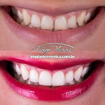 Dentista Londrina Dr Tiago Veras