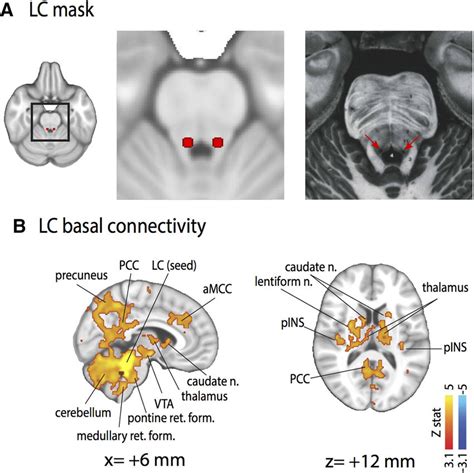 Functional Connectivity Of The Locus Ceruleus A Lc Seed Displayed On