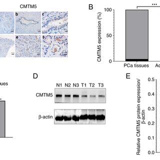 Cmtm Expression Is Downregulated In Pca Tissues A Representative