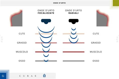 Onde Durto Spalla A Cosa Servono E Come Si Eseguono