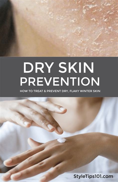 Flaky, Dry Skin Prevention and Treatment