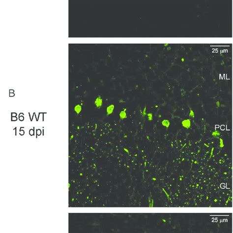 Zikv Infection Results In Neurodegeneration Confocal Imaging Of Download Scientific Diagram