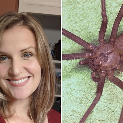 Brown Recluse Spider Bites Diethyl Azelate For The Treatment Of Brown