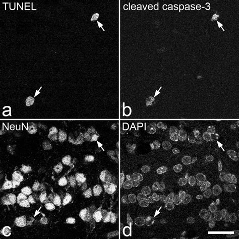 Cleaved Caspase 3 And Tunel Staining In The Olfactory Bulb Of A Naive