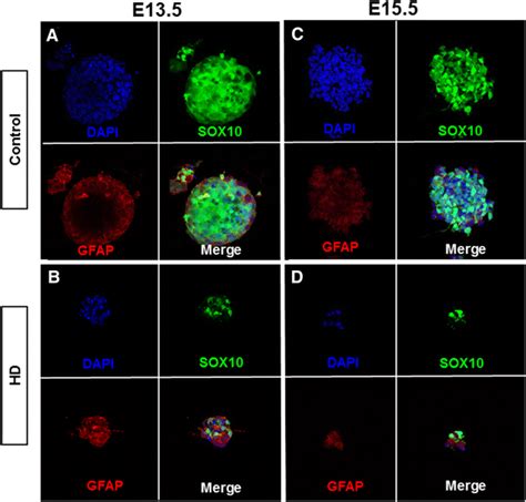 Immunofluorescent Staining Of Gfap Positive Cells Within Neurospheres