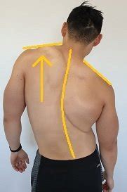 Scoliosis Exercises Posture Direct