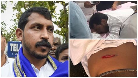 Bhim Army Chief Chandrashekhar Azad Ravan Shot At In UP S Saharanpur