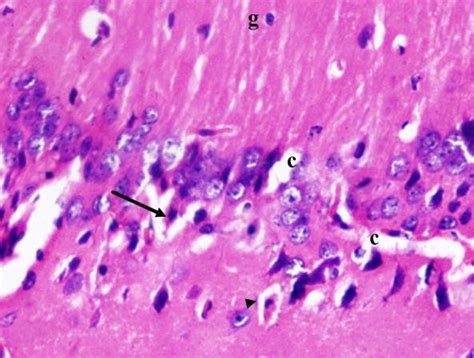 A photomicrograph of a coronal section of the hippocampus of an adult ... 
