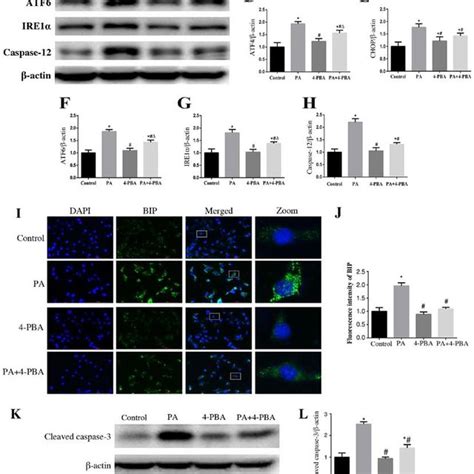 Endoplasmic Reticulum Stress Is Involved In Pa Induced Apoptosis Of