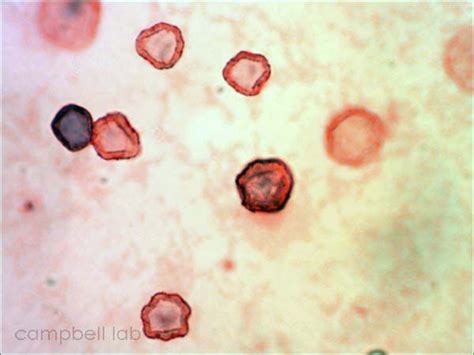 Acanthamoebae Cysts Gram Stain Culture Laboratory Science Medical Medical Center